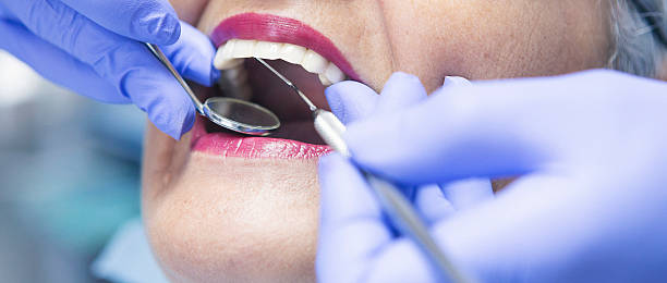 Best Emergency Broken Tooth Repair in Moa, UT